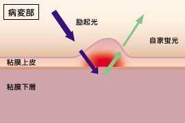 AFI図2