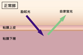AFI図1