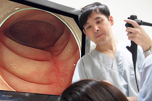 大腸内視鏡検査