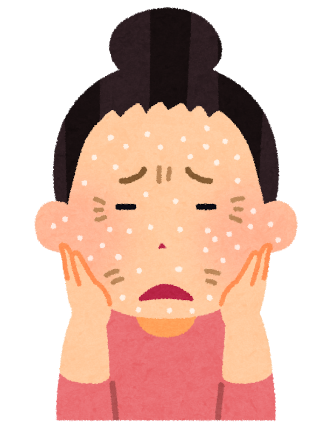 肌荒れ女性